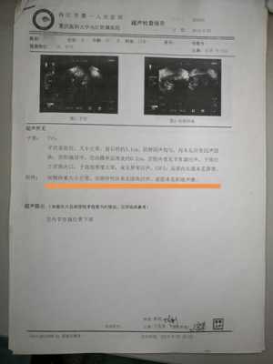 六安江天新能源汽车（卵巢囊肿术后白细胞高）-图1